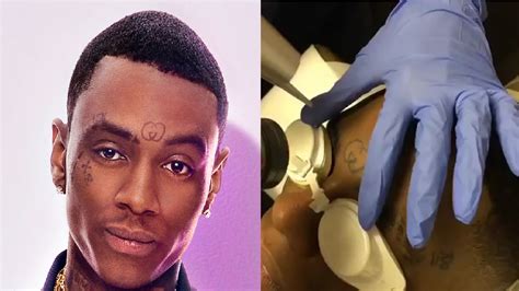 gucci face tattoo removal